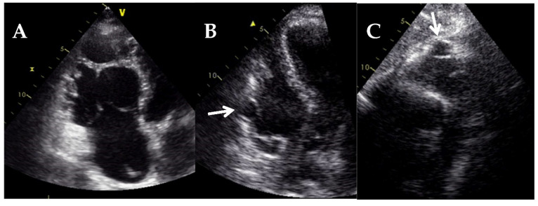 Figure 21