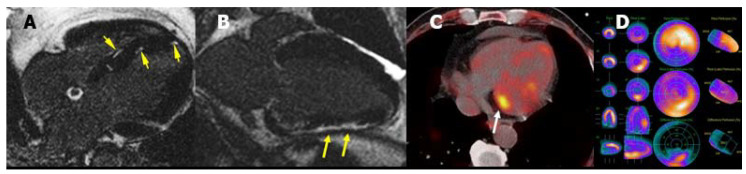 Figure 19