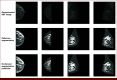 FIG 2.