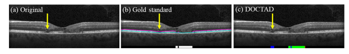 Fig. 11