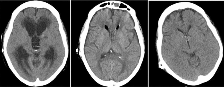 Fig. 3
