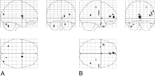 Fig 2.