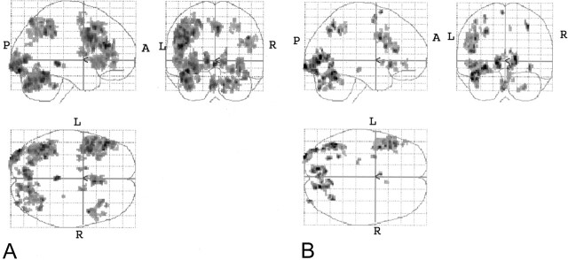 Fig 4.