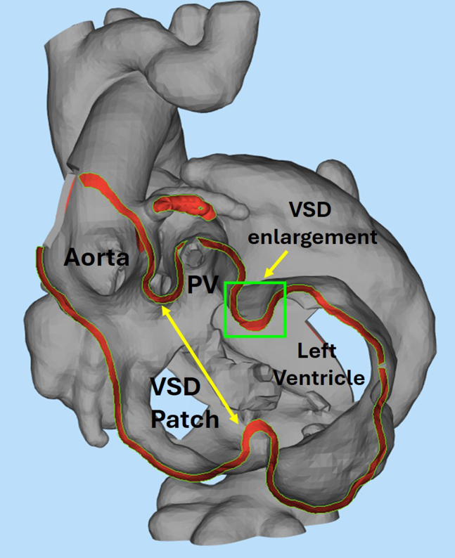 Figure 1