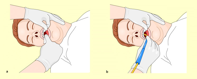 graphic file with name 6376_9_De_46_Fig2_HTML.jpg
