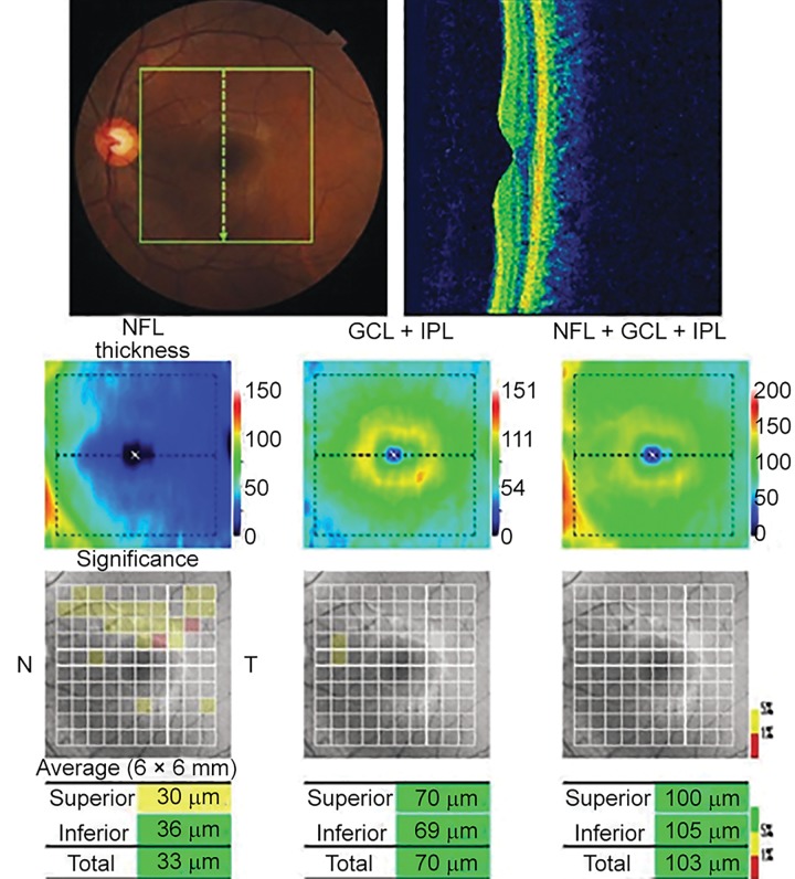 Fig. 2