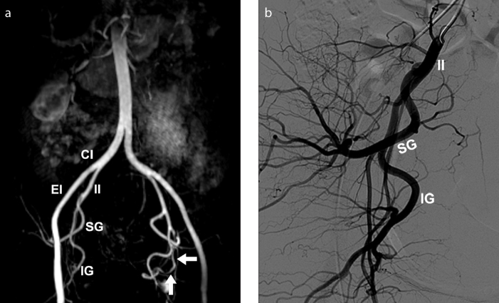 Figure 14. a, b