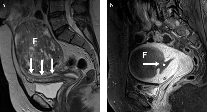 Figure 6. a, b