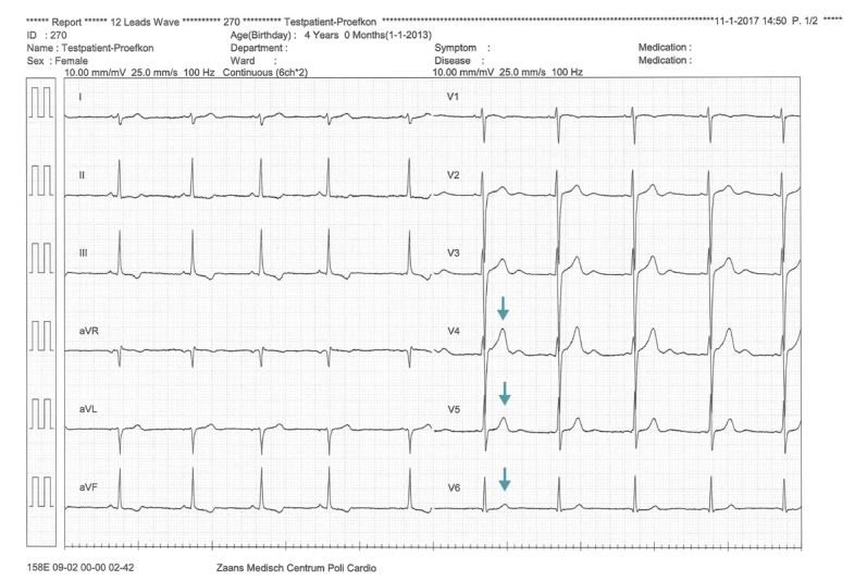 Figure 14