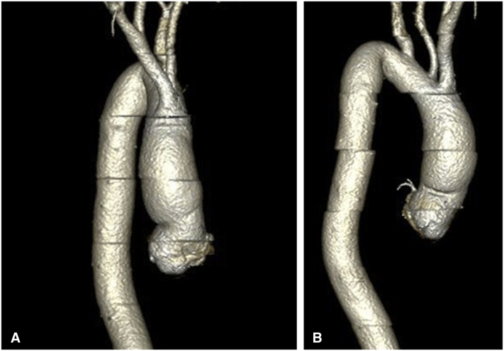 Figure E1