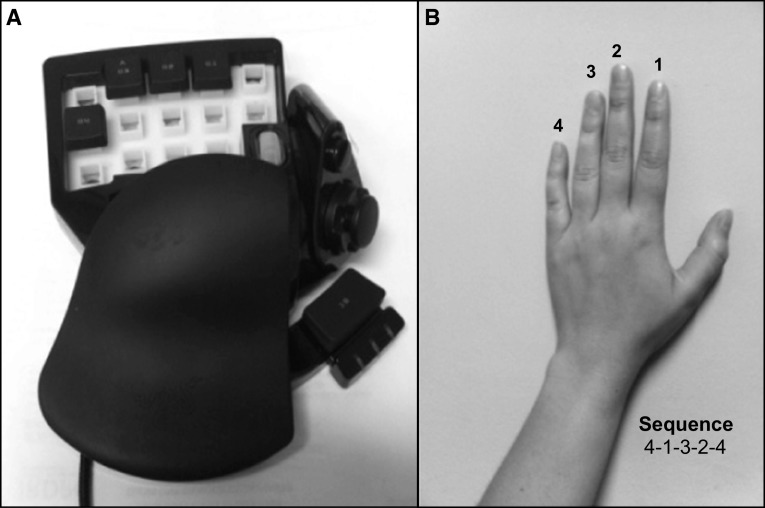 Fig. 1