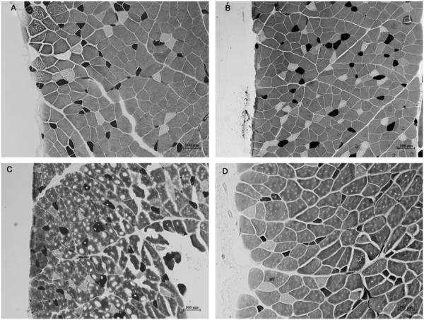 Reversibility of Abdominal Wall Atrophy and Fibrosis After Primary or ...