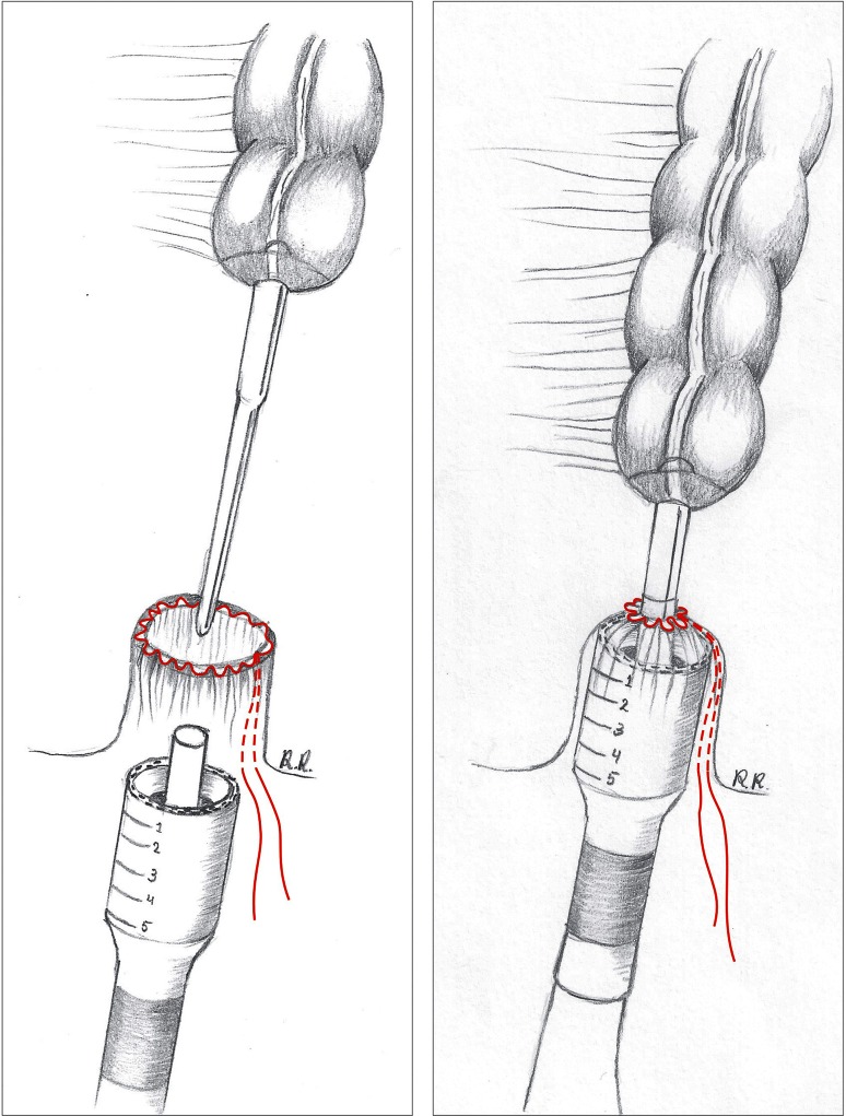 Fig. 2