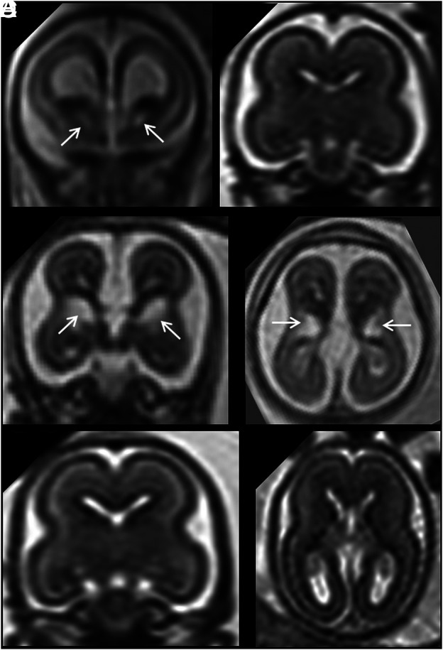 FIG 2.