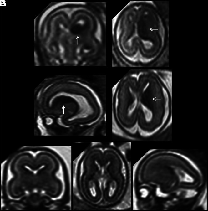 FIG 5.