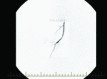 Fig. 2B