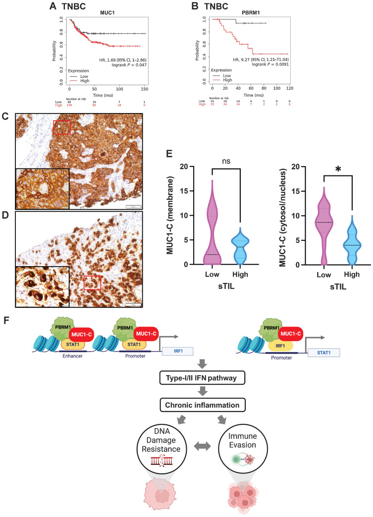 Figure 7. MUC1 and PBRM1 associate with decreases in responsiveness of TNBC tumors to chemotherapy. A and B, Kaplan–Meier curves for relapse-free survival created by the public database and web application KM plotter (http://kmplot.com/analysis/) based on the MUC1 (A) and PBRM1 (B) expression levels. Patients with TNBC were stratified with high (red) or low (black) expression of MUC1 and PBRM1. C and D, Representative MUC1-C staining in cell membrane (C) and cytosol/nuclear (D) of primary TNBC samples (magnifications, ×20). Insets highlight localization of MUC1-C expression in cancer cells (magnifications, ×100). E, TNBC tumors with cell membrane (left) and cytosol/nuclear (right) MUC1-C expression were stratified with sTIL levels in TNBC samples. F, Proposed model based on the present data demonstrating that MUC1-C induces PBRM1 expression and, in turn, binds to PBRM1. MUC1-C/PBRM1 complexes associate with (i) STAT1 in activating the IRF1 gene and (ii) IRF1 in activating STAT1 by increasing chromatin accessibility and their transcription. Induction of STAT1 and IRF1 expression contributes to a feed-forward circuit in which MUC1-C/PBRM1/STAT1 and MUC1-C/PBRM1/IRF1 complexes drive activation of genes in the type I and II IFN pathways. In this way, prolonged MUC1-C activation in settings of repetitive cycles of damage and repair promote chronic inflammation. A consequence of persistent MUC1-C activation and PBRM1-mediated chromatin remodeling is the establishment of IFN gene signatures that contribute to the CSC state and DNA damage resistance. DNA damage-induced inflammatory signaling is coupled to immune evasion, which in turn contributes to a MUC1-C/PBRM1-driven auto-inductive circuit that integrates a refractory state to treatment with genotoxic and immunotherapeutic agents. Figure created with BioRender.com.