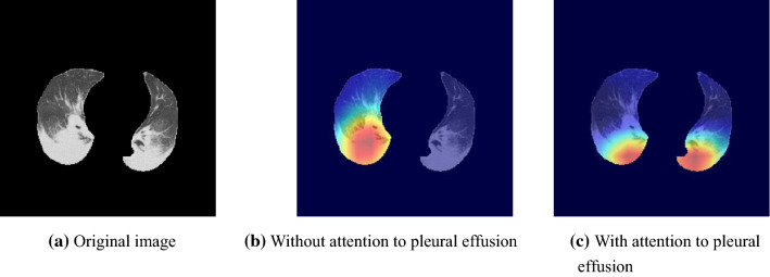 Fig. 14