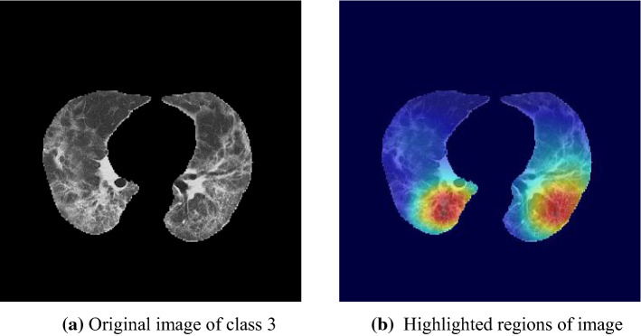 Fig. 15