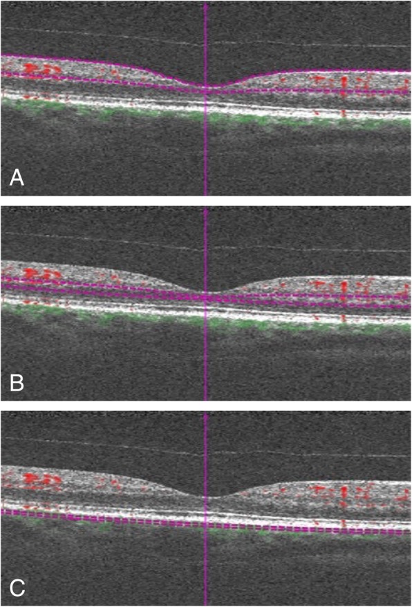 Fig. 1