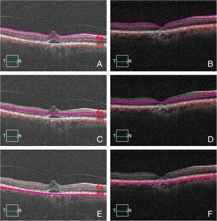 Fig. 3