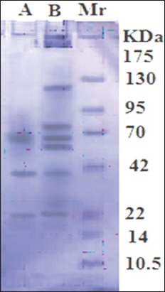 Figure-5