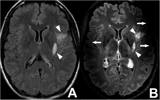 Fig. 7.