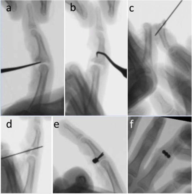 Figure 2.