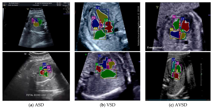 Figure 14