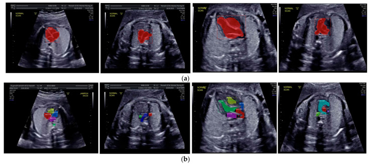 Figure 10