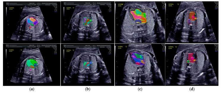 Figure 11