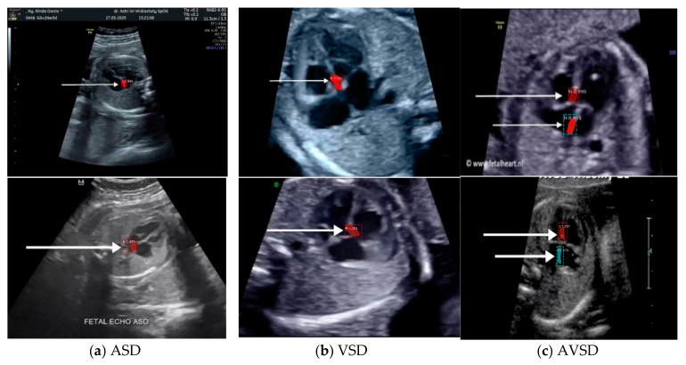 Figure 12