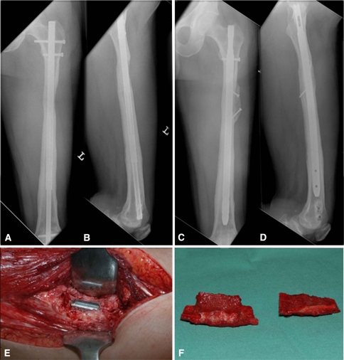 Fig. 2A–F