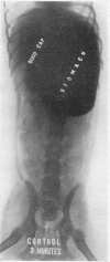 352-1