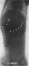 352-3