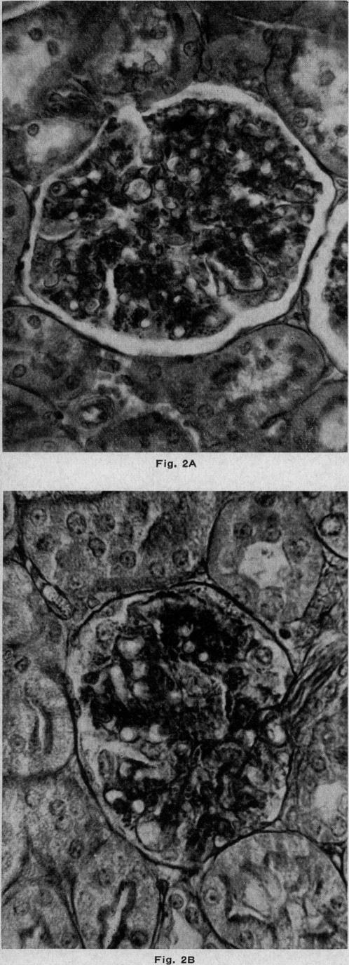 Figs. 2A and 2B