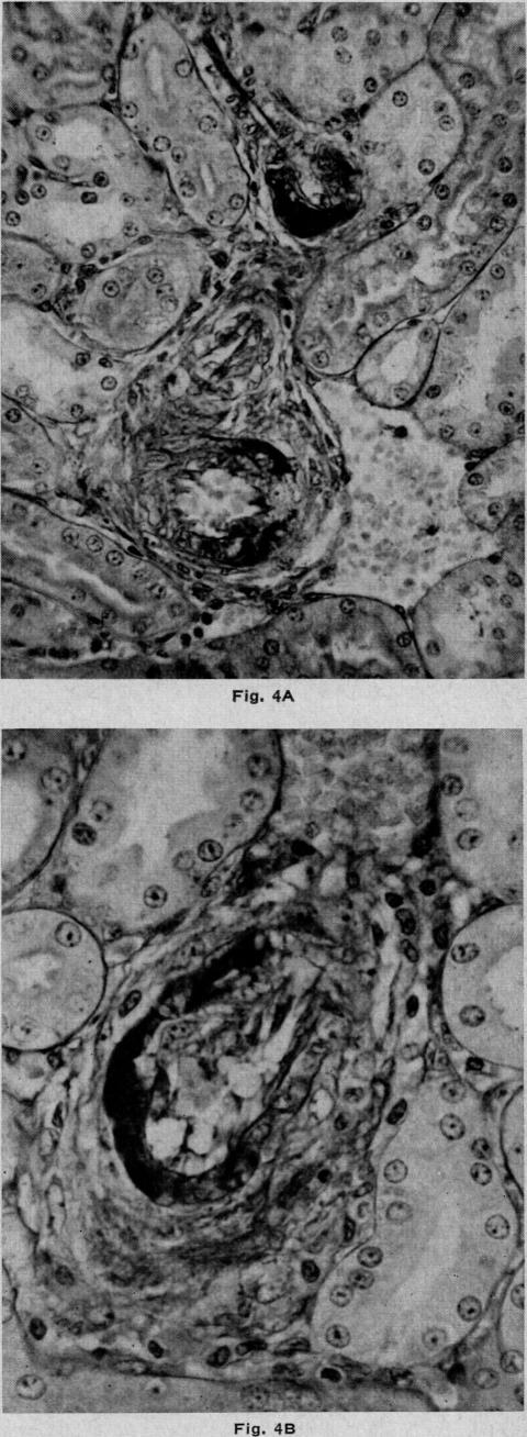 Figs. 4A and 4B