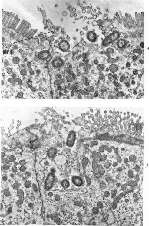 Figs. 4 and 5