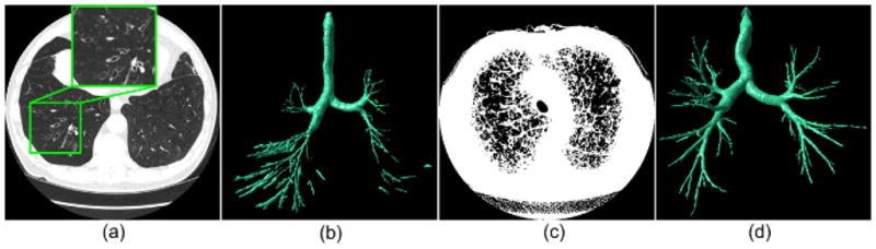 Fig. 16