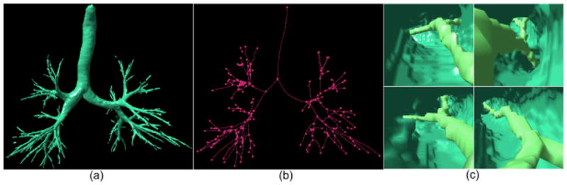 Fig. 12