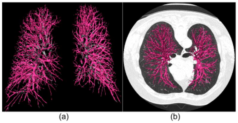 Fig. 15