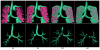 Fig. 11