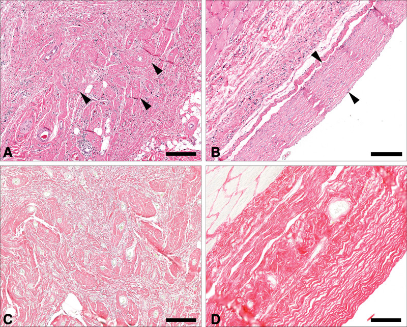 Fig. 12.