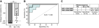 Figure 3. Early changes in KRAS MAF are associated with clinical benefit. A, Percentage change in KRAS MAF after one cycle of treatment from baseline according to best response. Fifteen patients were included in the analyses, 7 with PR, and 8 with either SD or PD as best response. Data analyzed by unpaired t test with Welch correction, **, P < 0.01. B, ROC curve for clinical response prediction, showing the sensitivity and specificity of KRAS-mutant ctDNA decrease after one cycle to predict clinical response. 95% CIs are shown in blue. C, Patient with ≥90% decrease in KRAS MAF from baseline were considered molecular responders. Sensitivity, specificity, positive predictive value (PPV), and negative predictive value (NPV) of the KRAS-mutant ctDNA plasma test to predict clinical response are reported.