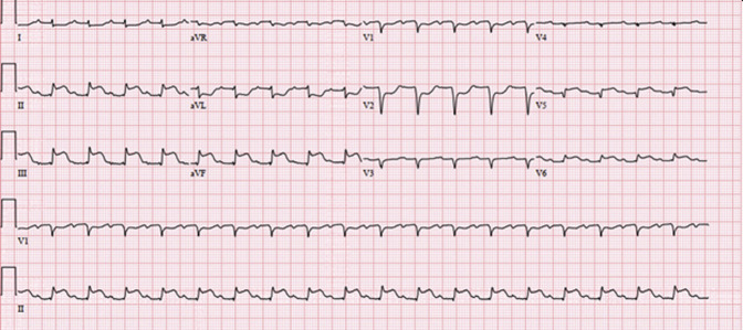 Figure 1