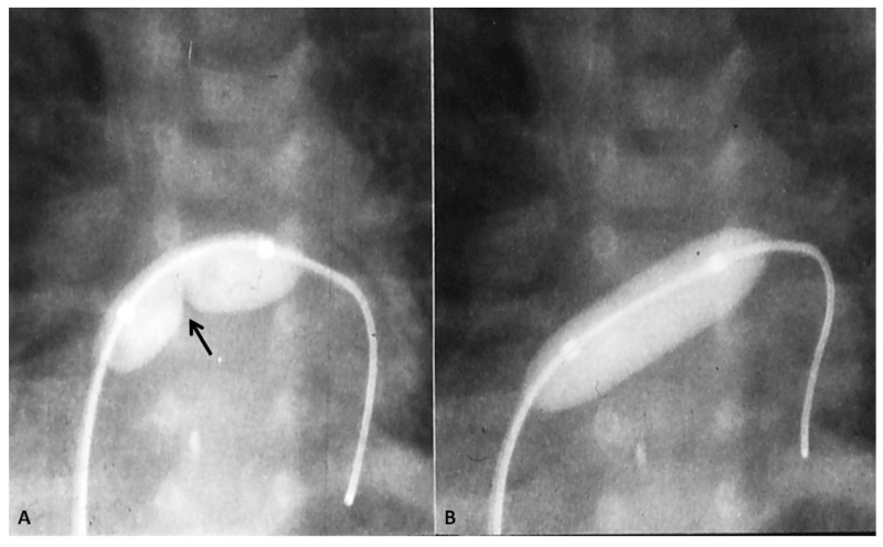 Figure 12