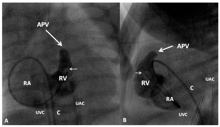 Figure 14