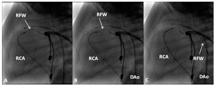 Figure 15