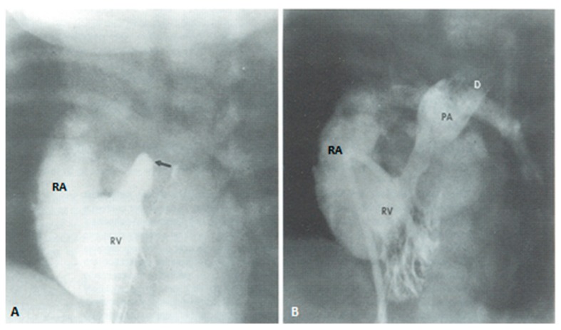 Figure 17