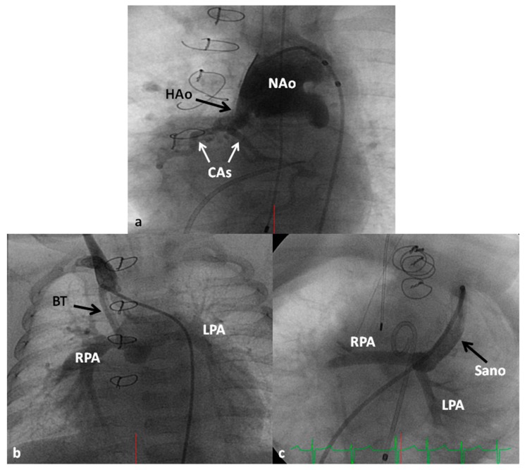 Figure 13